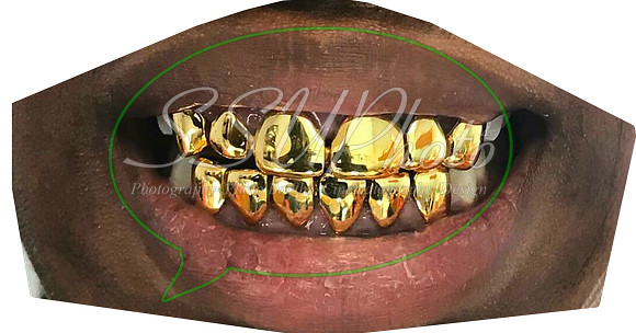 goldsmile