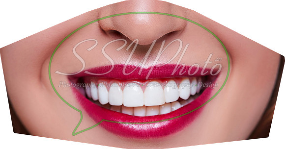 perfectsmile001