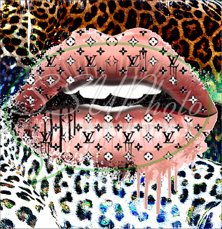 LVPatterns14